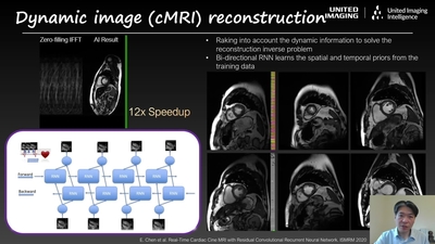 AI in Medical Imaging and Smart Medical Devices